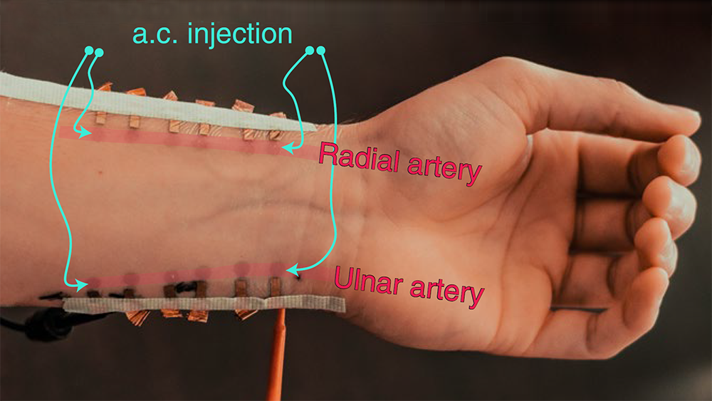 石墨烯传感器在红色标记下几乎看不见，用于测量血压。